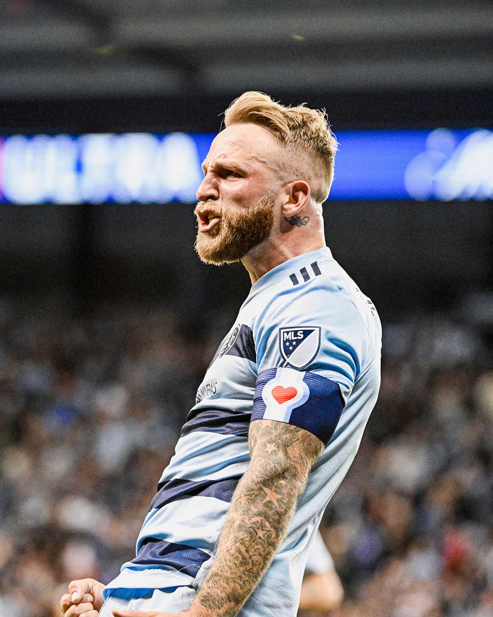 Kansas City flag design shown as an arm band worn on wrist